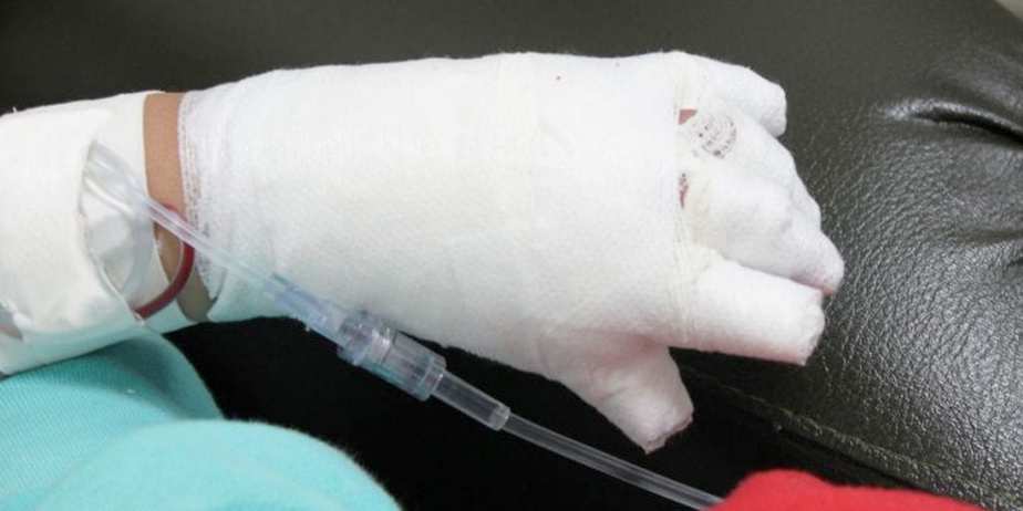 Otro menor quemado con pólvora en el Huila