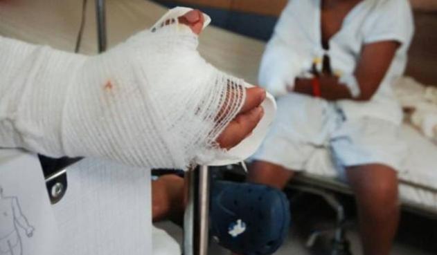 Mujer wayúu perdió dedos de su mano al explotarle una bolsa de basura